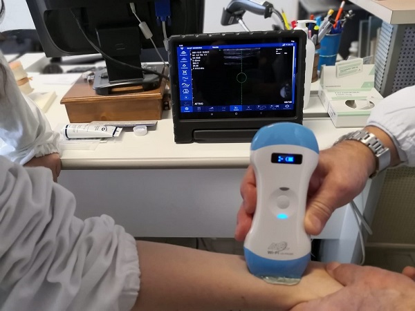 La sonda in azione